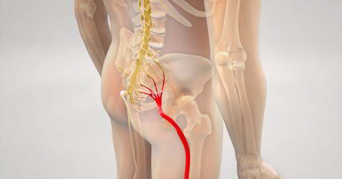 Can Chiropractic Care Help Relieve My Sciatica? image